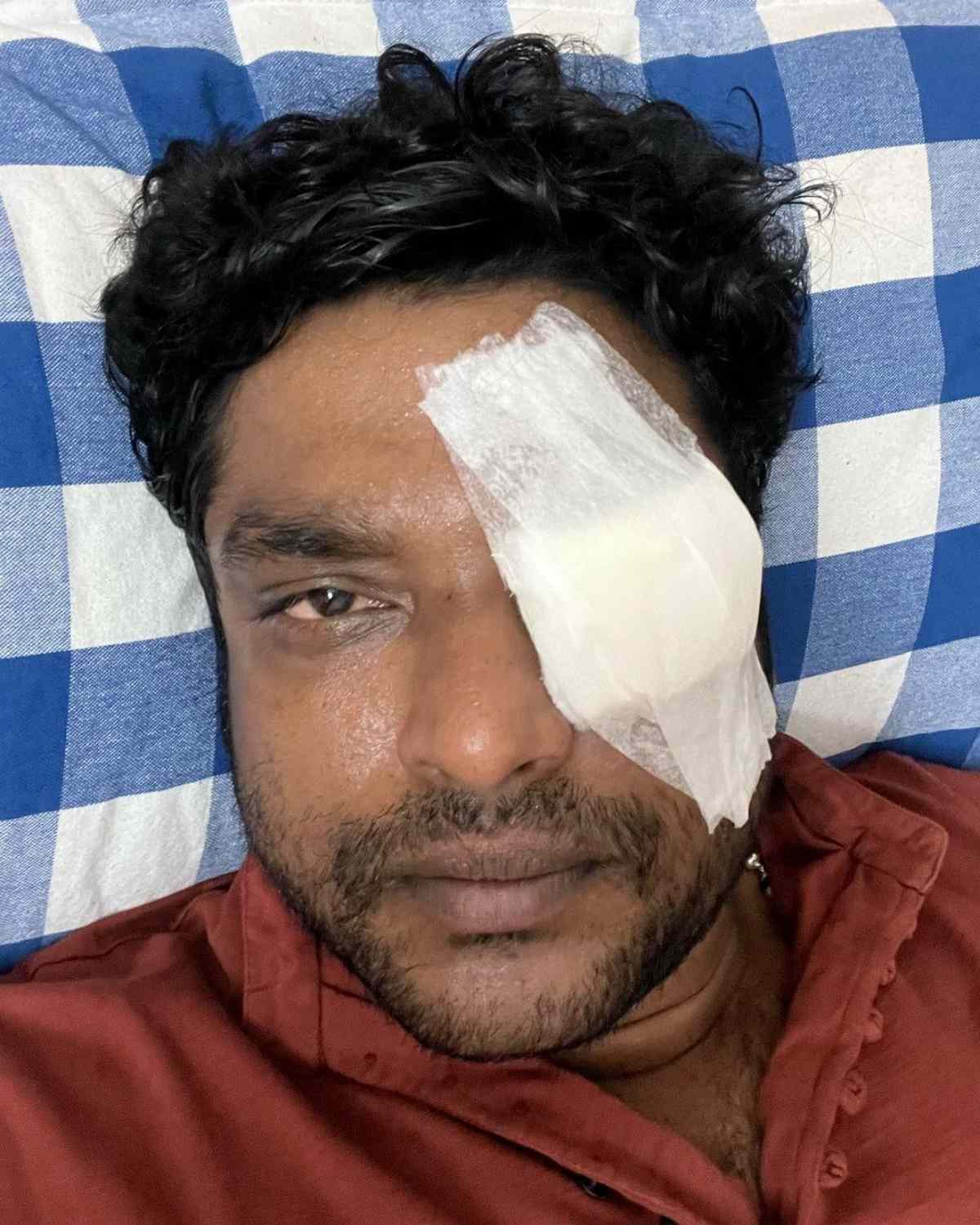  Vijay Tv serial actor Sakthivel eyes injured due to roadside stones 