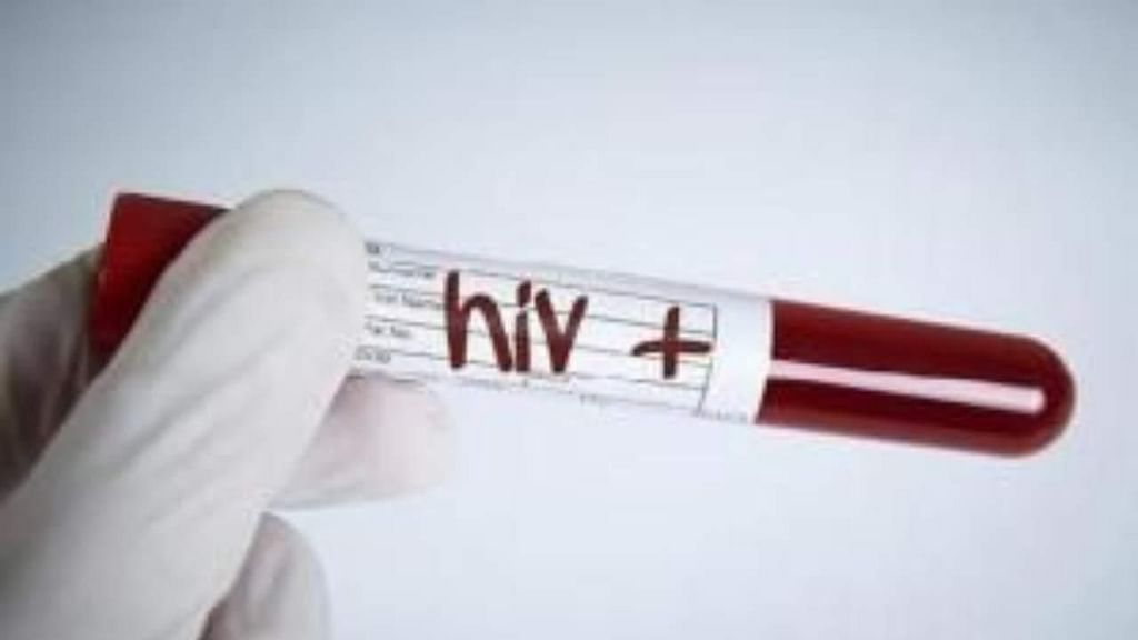 HIV