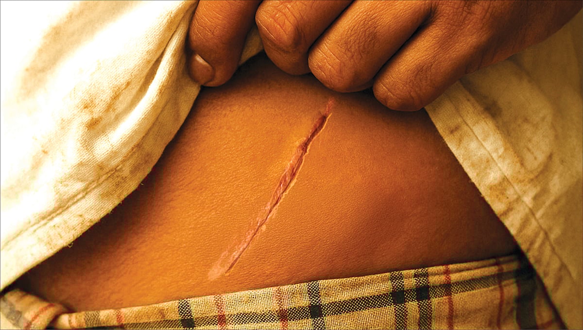 கிட்னி திருட்டு